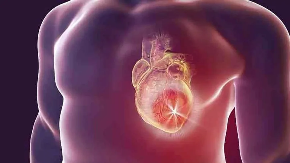 Aumento del 11% en Muertes por Infarto en Costa Rica