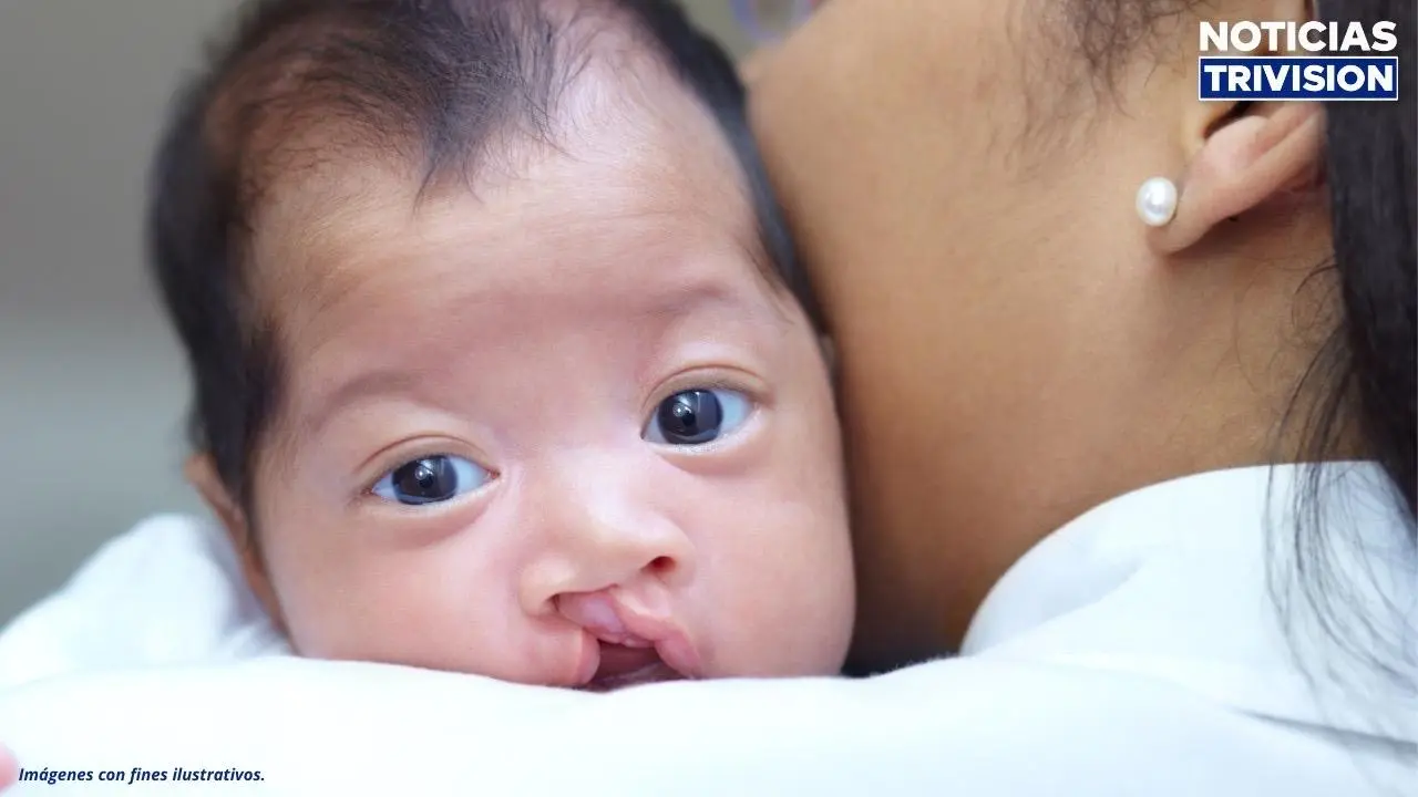 Hospital de Niños realiza exitosa jornada quirúrgica y beneficia a 57 menores