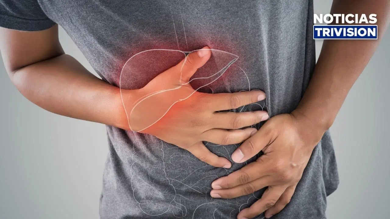 Salud reporta bajo control casos de hepatitis A en Aserrí y Desamparados