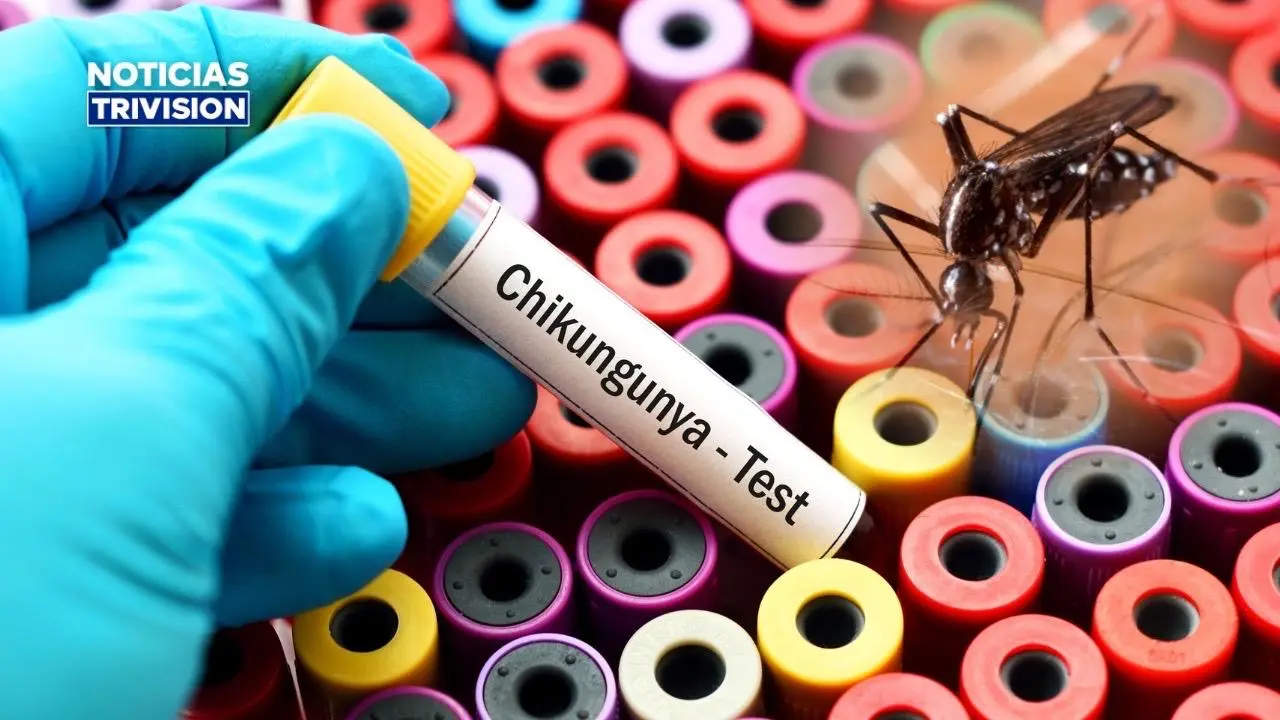 Costa Rica alcanza los 300 casos de chikungunya en 2026